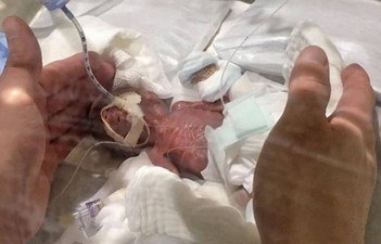 World’s smallest premature baby boy has left hospital healthy
