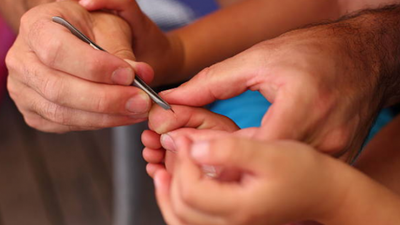 One mum shared the most genius trick for getting out splinters – and it is SO simple