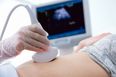 Partners to be allowed to attend 20 week scans, says HSE