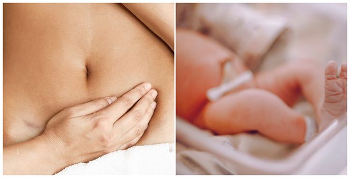 husband asks wife to have a c-section birth to not ruin their sex life