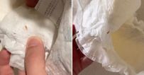 “What the F is this”: Mum claims to have found maggot in unused nappy