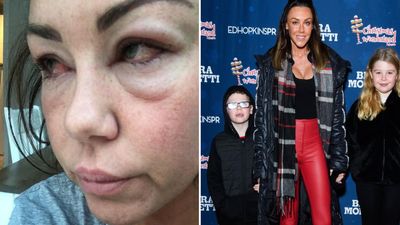“I almost died”: Michelle Heaton gets real about her battle with addiction