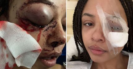 Ballyfermot residents to hold vigil as over €55k raised for assaulted teen Alanna Quinn Idris