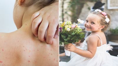 Bride asks to remove niece as flower girl “because of how she looks”