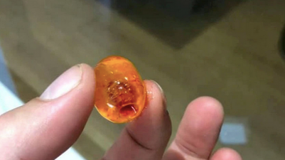 Dad calls for lollipops to be banned after horrifying incident with son