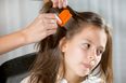 3 helpful tips for treating and preventing head lice at home