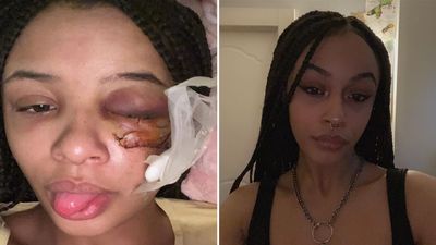 Mother of Alanna Quinn Idris reveals people keep staring at her daughter