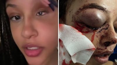 Alanna Quinn Idris shares heartbreaking update after Ballyfermot attack