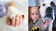 “It can happen”: Mum issues stark warning to parents after her dog attacks toddler