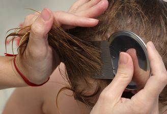 Irish children going without head lice treatment because parents can’t afford it