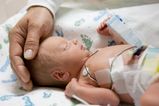 Most premature babies have no long term health issues, study finds