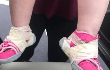 Creche called out after taping shoes to infant’s feet