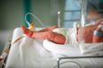 What is congenital pneumonia and how do babies get it?