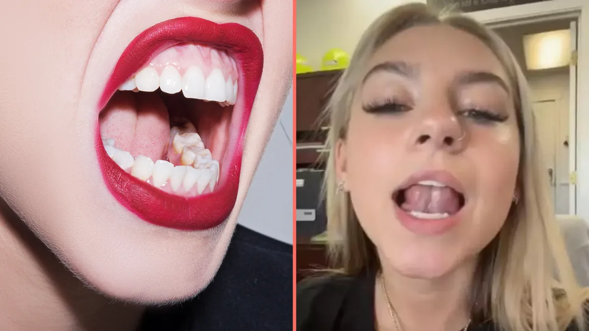 ‘Gleeking’ is the ‘disgusting’ bodily function that most people don’t know they can do