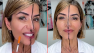 Doctor reveals the side effects of Botox after injecting only one side of her face