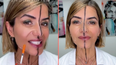 Doctor reveals the side effects of Botox after injecting only one side of her face